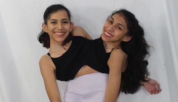 Povestea gemenelor siameze Carmen și Lupita Andrade. Cum arată viața lor la 22 de ani
