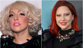 Lady Gaga, cu fizionomia schimbată radical. Vedeta arată diferit, iar chirurgii esteticieni și-au dat seama ce operații și-a făcut