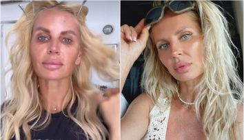 Andreea Bănică și-a rezolvat problemele cu tenul pătat. Vedeta și-a afișat look-ul impecabil în Sardinia