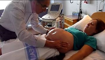Momentul incredibil in care un bebelus aflat in burta mamei sale este intors de un doctor doar cu mainile - VIDEO