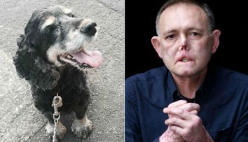 Si-a pierdut ambele picioare, 5 degete si parti ale fetei, din cauza ca s-a jucat cu cainele sau. Motivul pare ireal