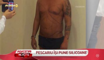 EL este primul barbat din Romania care si-a pus SILICOANE. Cum arata acum