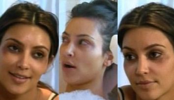 Kim Kardashian nu mai vrea botox! “Niciodata”!
