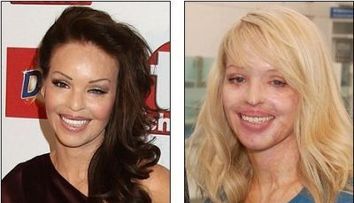 Katie Piper redevine o tanara incantatoare, dupa ce a fost violata si arsa cu acid sulfuric de fostul prieten - FOTO