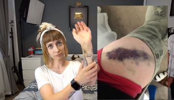 Bianca Adam, alias Tequila, bătută în parcare de un dezvoltator imobiliar. Ce chin a îndurat