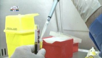 Afla ce trebuie sa faci ca sa eviti atacurile de panica si accidentele vasculare!
