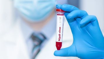 Cum se transmite virusul Nipah și cât de periculos este. Kazahstanul intensifică controlul la frontiere, după ce primele cazuri de infectare s-au înregistrat în India