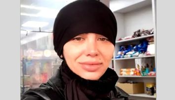 O tiktokeriță din România, apariție tulburătoare în mediul online! Tânăra și-a speriat fanii după ce s-a afișat cu fața tumefiată pe rețelele de socializare