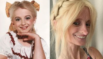Cum arată la 48 de ani o femeie diagnosticată cu progeria. Medicii îi dădeau doar 12 ani de viață