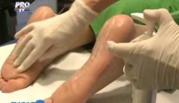 Pielea aspra si crapata de pe calcaie, mai mult decat o problema estetica! VIDEO
