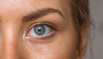 (P) Dermatita atopică, de la cauză la tratament