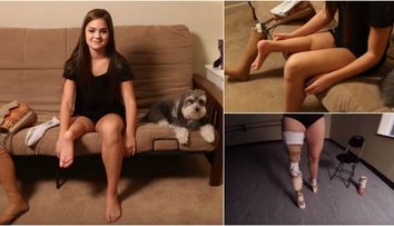 Trupul sau a fost mutilat de cancer, dar a continuat sa danseze desi poarta proteza. Lectia de viata oferita de o tanara