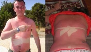 Bronzuri dezastruoase! FOTO