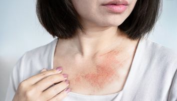 O femeie a crezut că este alergică la materialul rochiei, dar testele au arătat altceva. Substanța ascunsă care i-a provocat iritații pe tot corpul