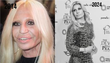 Donatella Versace nu renunță la operații estetice nici la 69 de ani. Fanii, siderați: “Ce și-a mai făcut la față?”