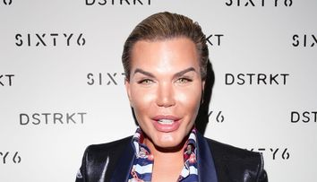 Decizie uimitoare pentru Rodrigo Alves. Are interzis la liposuctii, dar vrea sa faca asta: 