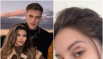Valerie Lungu a apărut cu ochiul vânăt pe internet. Celebra influenceriță a povestit ce a pățit, iar fanii au avut un șoc. Ce s-a întâmplat