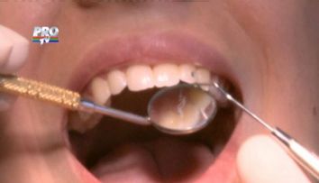 Aflati cum sa combateti fobia de dentist a copiilor!