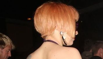 Lady Gaga, cu fata tumefiata dupa accidentul de pe scena. Vezi cum arata dupa ce i-a cazut o bara metalica in cap - FOTO