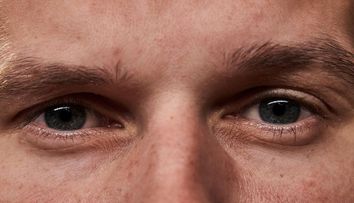 „Acești ochi au văzut multe”. Cum arată acum Dmitro, autorul fotografiilor din uzina Azovstal, după eliberarea din captivitate