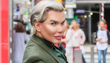 Are 57 de operatii estetice, dar nu se opreste aici. La ce procedura va recurge Rodrigo Alves