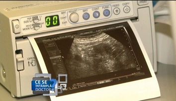 Afla ce trebuie sa faci pentru a preveni cancerul la san!