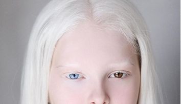 Amina, fetița cu albinism de o frumuseţe nepământeană uimește întreaga lume. A fost descoperită de o fotografă