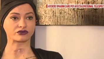 Povestea lui Tedy, pasarea Phoenix din Colectiv, data afara din spitalul AKH din Viena: 