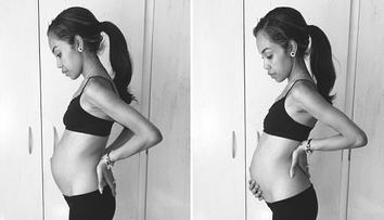 Insarcinata si anorexica. A nascut un copil perfect sanatos, desi in luna a opta de sarcina cantarea doar 51 de kilograme: FOTO