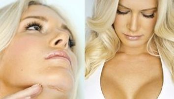 Heidi Montag isi arata cicatricile! FOTO  