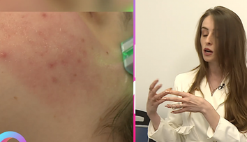 Totul despre tratamentul facial cu celule stem. Ce spune un consilier în estetică