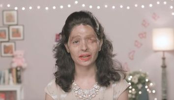 A fost arsa cu acid sulfuric la 17 ani. Un an mai tarziu, tutorialul sau de make-up transmite un mesaj cutremurator