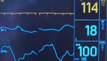 Decizia neasteptata a unei mame salveaza de la moarte un copil tinut in viata de aparate