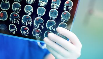Și-a făcut un RMN pentru durerile de spate, dar medicii i-au descoperit o tumoare cerebrală. Simptomele banale pe care le-a ignorat o femeie de 38 de ani: „Am crezut că o să mor”