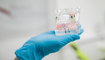 (P) Implanturile dentare pot necesita și adiție de os! Iată ce presupune această tehnică medicală!