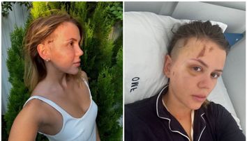 Emily Burghelea, schimbare radicală de look după accidentul grav din Mauritius: „Viața e prea scurtă ca să ne fie frică de schimbări”