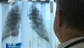 Uite ce boala poate ascunde o banala durere de stomac! VIDEO
