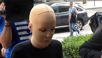 A purtat aproape 3 ani aceasta masca, acum merge zilnic pe strada fara ea. Cum arata chipul ei cu adevarat