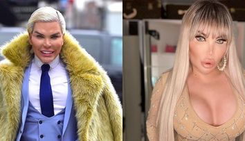 Jessica Alves, mutilată de intervențiile estetice. Imaginea care i-a șocat pe internauți