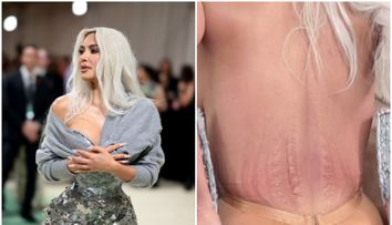 Urme adânci și piele vânătă! Kim Kardashian, marcată de rochia imposibilă de la Met Gala: „Nu am simțit atâta durere niciodată”