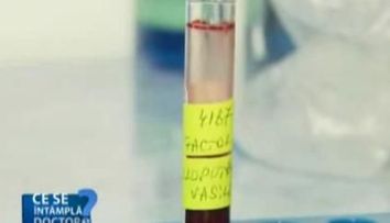 Cancerul pulmonar: afla care sunt simptomele si metodele de tratament! VIDEO