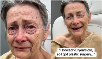 La 70 de ani și-a făcut un lifting facial, iar internauții au fost șocați de rezultat și l-au numit pe chirurgul plastician „omul-miracol”. Cum arată pensionara după procedura de întinerire