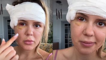 Emily Burghelea nu își poate reveni din șoc, după ce medicii au dat verdictul. Vedeta a primit un diagnostic ce a făcut-o să izbucnească în lacrimi: „Mi s-au mișcat oasele feței”