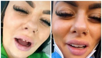 Prin ce chinuri a trecut o influenceriță de pe TikTok după ce și-a pus fațete dentare, de 42.000 de dolari