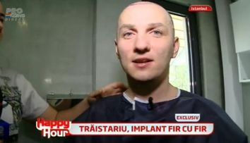 Transplantul de par a fost un succes. Lui Mihai Traistariu i-a crescut foarte mult parul si nu mai stie cum sa-l aranjeze: FOTO