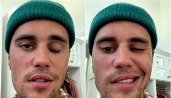 Justin Bieber, cu jumătate de față paralizată din cauza unei boli grave: “Vă rog, rugați-vă pentru mine”