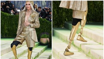 Cine este „fata cu picioarele de aur”, care a impresionat la Met Gala 2026. Și-a pierdut ambele picioare din cauza unei afecțiuni rare