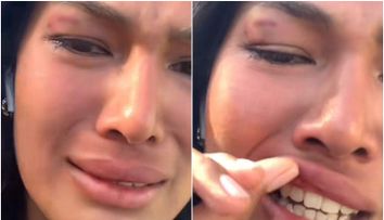 Influenceriță celebră, bătută cu bestialitate pe stradă! Tânăra a ajuns la spital după ce a fost lovită fără milă în față: „Îmi e frică să mai ies”
