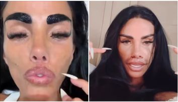 ”Buzele mele arată prea subțiri”. La 48 de ani, Katie Price, victima operațiilor estetice nereușite. Reacția fanilor: ”E timpul să-ți îmbrățișezi vârsta”