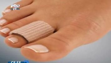 Bataturile, inestetice si periculoase! VIDEO